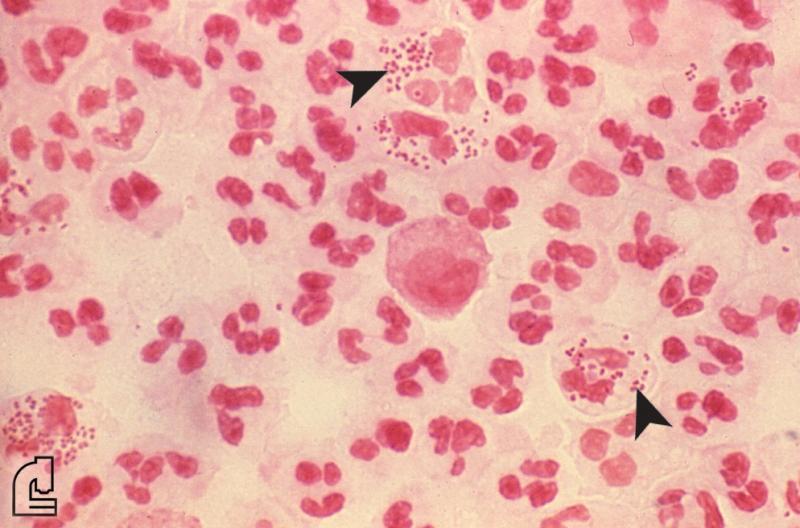 gram-stain